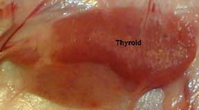 Greta skydliaukės nuotraukoje taip pat galima matyti prieskydinę liauką (toliau kairėje) ir limfmazgį (apačioje).